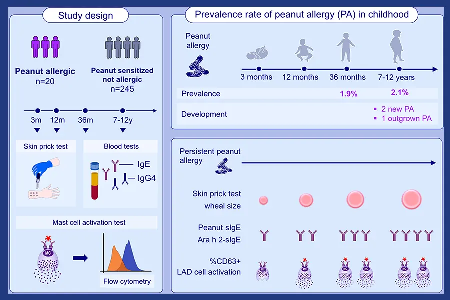 peanut allergy in children